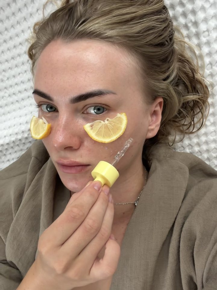 Julia applying a serum with lemon slices under her eyes